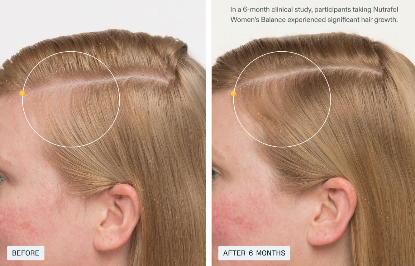 Nutrafol Women's Balance Hair Growth Supplement