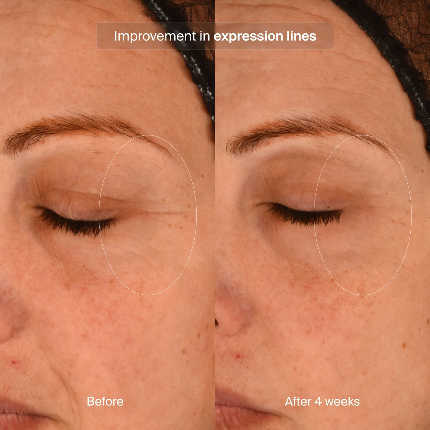 Pavise Precision Eye Lift