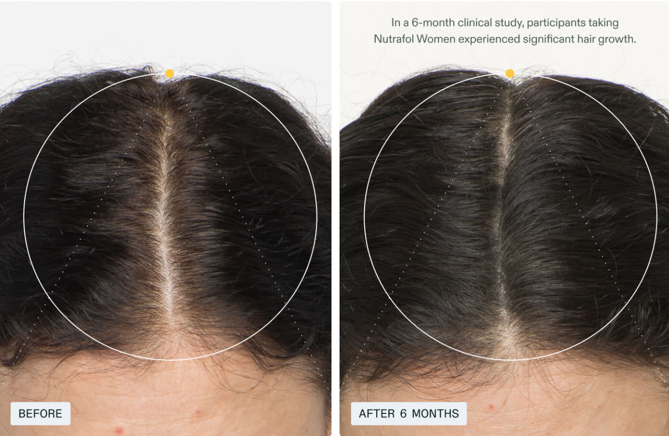 Nutrafol Women Hair Growth Supplement